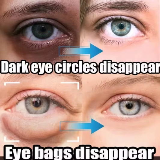 Instant Eye Bag Removal Cream Retinol Anti-Wrinkle Firming Skin Fade Fine Lines anti Dark Circle Puffiness Brighten Eye Care