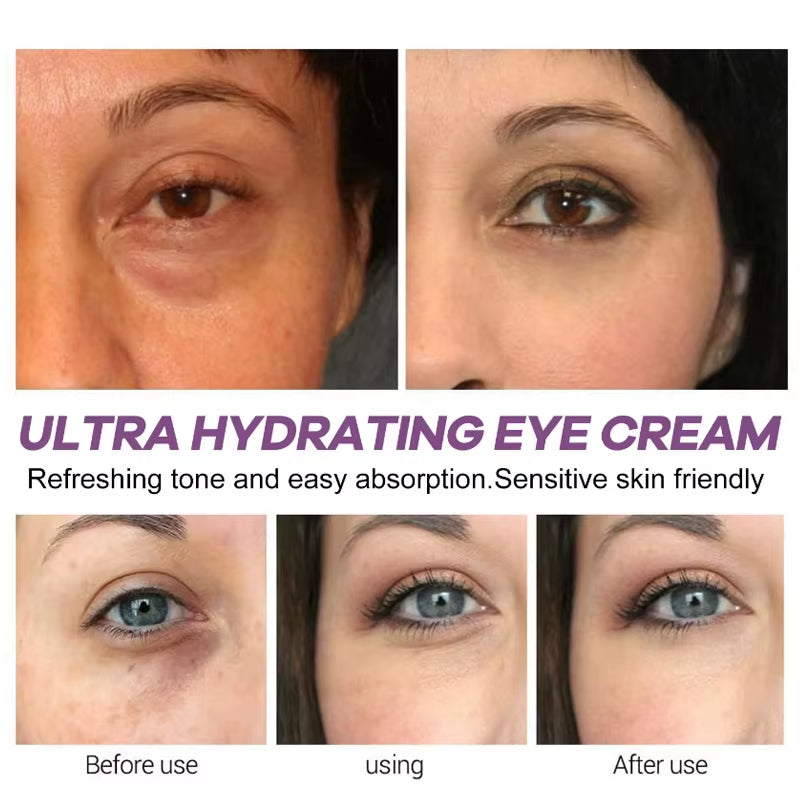 Instant Eye Bag Removal Cream Retinol Anti-Wrinkle Firming Skin Fade Fine Lines anti Dark Circle Puffiness Brighten Eye Care